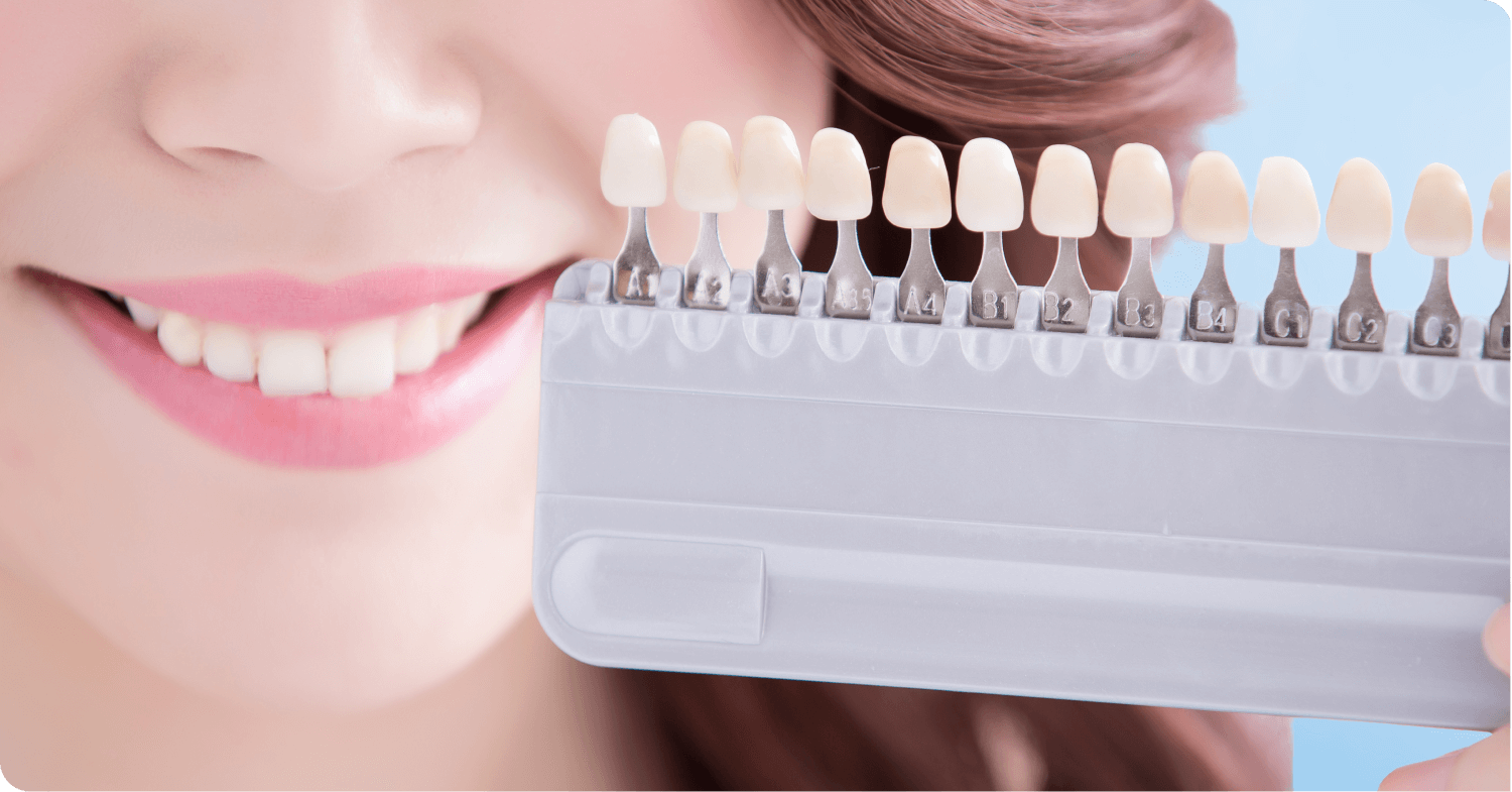 ホワイトニング - 高知市の歯科・歯医者なら嶋本歯科クリニック