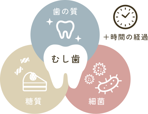 むし歯の原因