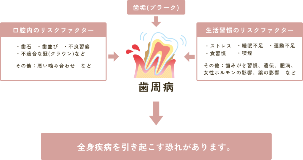歯周病の間接的原因